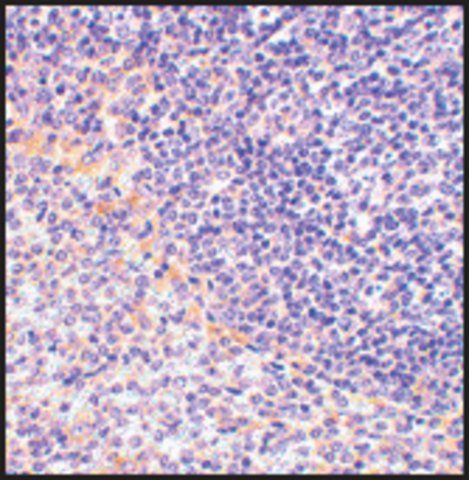 Anti-FAF1 antibody produced in rabbit