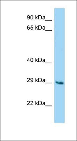 Anti-FAM122B antibody produced in rabbit