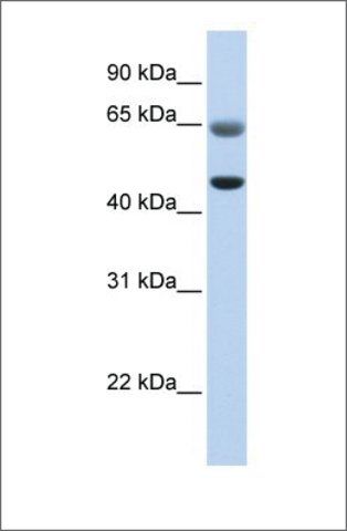 Anti-FAM113A antibody produced in rabbit