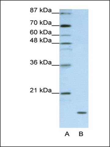 Anti-FAM121B (AB1) antibody produced in rabbit