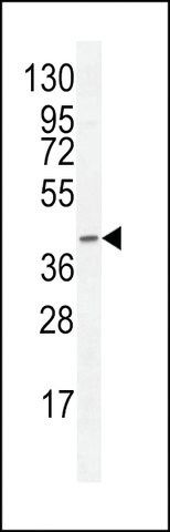 ANTI-F8A2(N-TERMINAL) antibody produced in rabbit