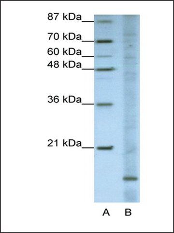 Anti-FAM121B (AB2) antibody produced in rabbit