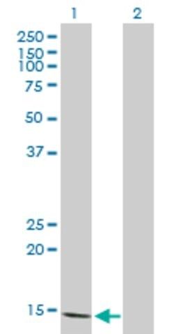 Anti-FABP5 antibody produced in mouse