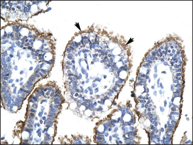 Anti-FLJ20729 antibody produced in rabbit