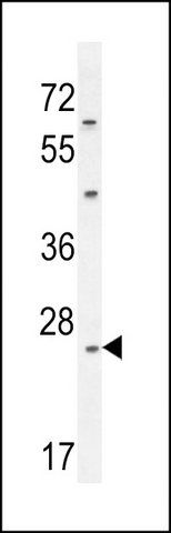 ANTI-CLDN22 (CENTER) antibody produced in rabbit