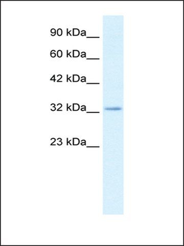 Anti-CLDN10 antibody produced in rabbit