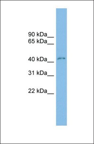 Anti-CLEC4M antibody produced in rabbit