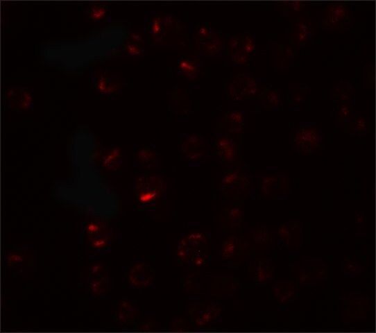 Anti-CLEC2A antibody produced in rabbit