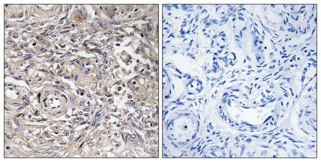 Anti-CLDN6 antibody produced in rabbit