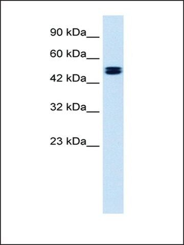 Anti-CLCN6 antibody produced in rabbit