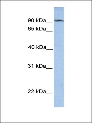 Anti-CLPB antibody produced in rabbit