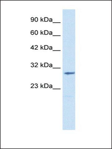 Anti-CLIC2 (AB2) antibody produced in rabbit