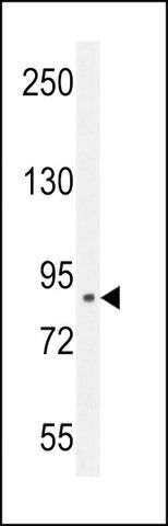 ANTI-CLIC6 (CENTER) antibody produced in rabbit