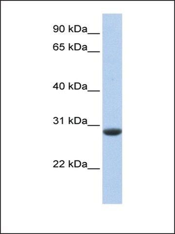 Anti-CLDND1