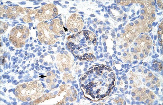 Anti-CLIC5 antibody produced in rabbit