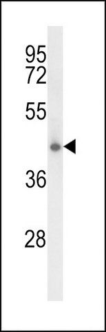 ANTI-CLN5 (N-TERM) antibody produced in rabbit