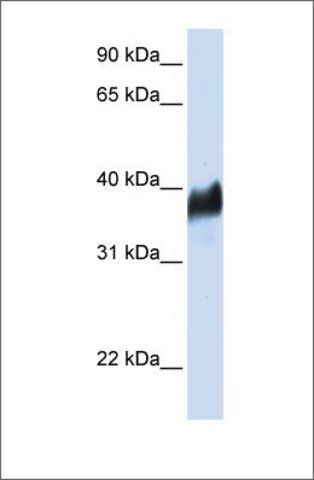 Anti-CLN8 (ab2) antibody produced in rabbit