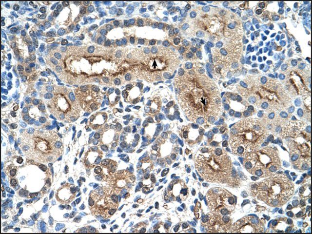 Anti-CLEC4M antibody produced in rabbit