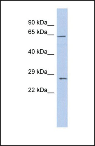 Anti-CLDN18 antibody produced in rabbit