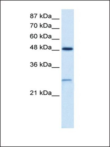 Anti-CLIC4 antibody produced in rabbit