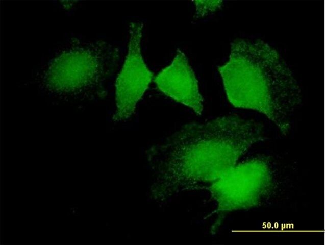 Anti-CNN2 antibody produced in mouse