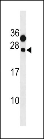 ANTI-CLEC6A(C-TERMINAL) antibody produced in rabbit