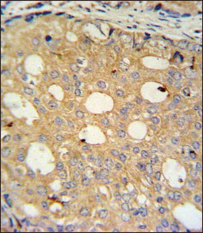 ANTI-CMPK2 (CENTER) antibody produced in rabbit