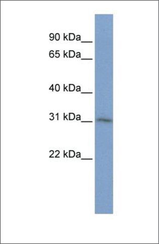 Anti-CMTM2 antibody produced in rabbit