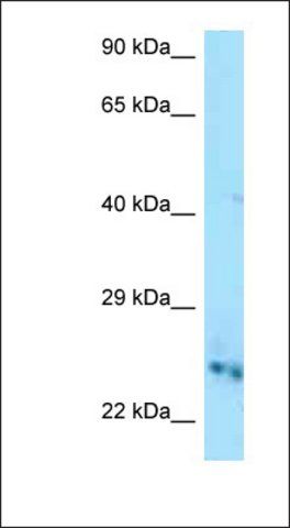 Anti-CMPK1 antibody produced in rabbit