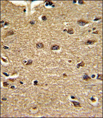 ANTI-CLUAP1 (C-TERM) antibody produced in rabbit