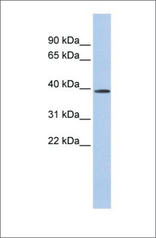 Anti-CLN6 (ab2) antibody produced in rabbit