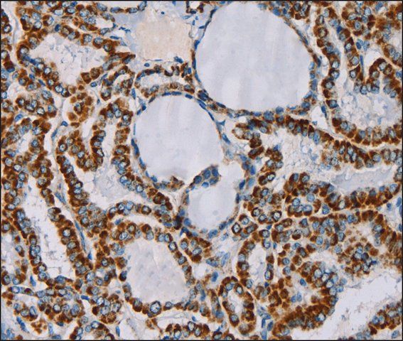 Anti-CMC4 antibody produced in rabbit