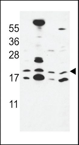 ANTI-CNPY2(C-TERMINAL) antibody produced in rabbit