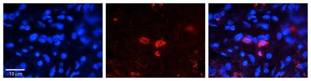 Anti-CLN6 (ab1) antibody produced in rabbit