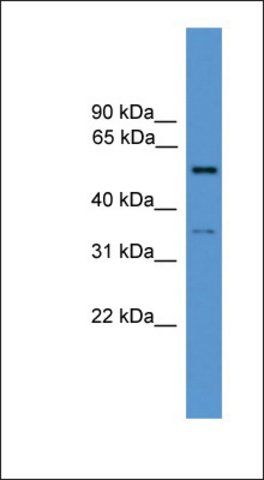 Anti-COCH antibody produced in rabbit