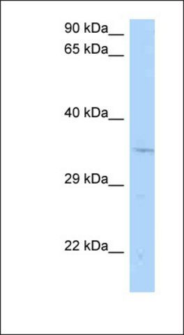 Anti-CNTD1 antibody produced in rabbit