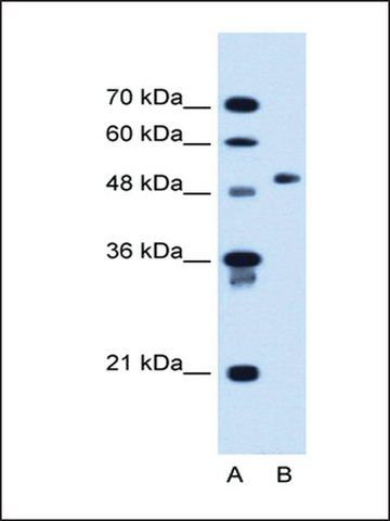 Anti-COL6A2 antibody produced in rabbit