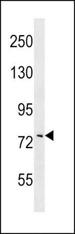 ANTI-COL8A1 (N-TERM) antibody produced in rabbit