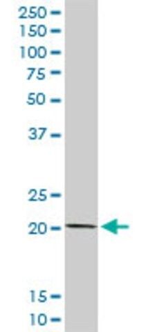 Anti-COMMD1 antibody produced in rabbit