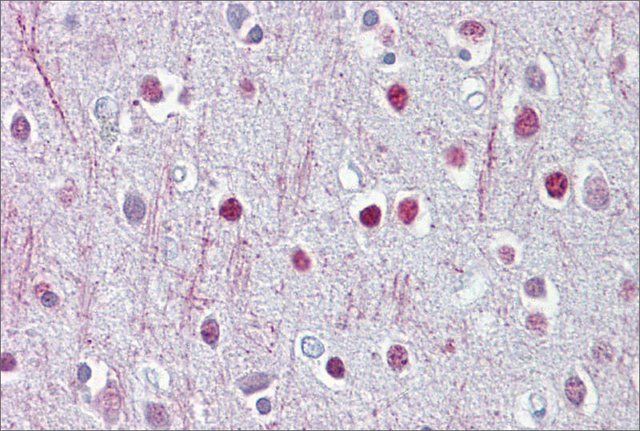 Anti-CNP antibody produced in rabbit