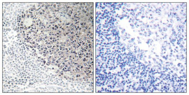 Anti-Collagen IX 3 antibody produced in rabbit