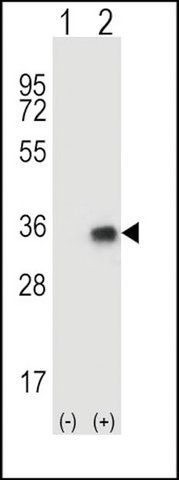 ANTI-CNOT8 (N-TERM) antibody produced in rabbit