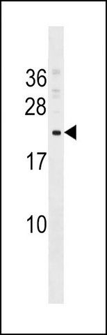 ANTI-COMMD9 (C-TERM) antibody produced in rabbit