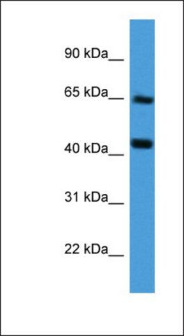 Anti-COL8A2 antibody produced in rabbit