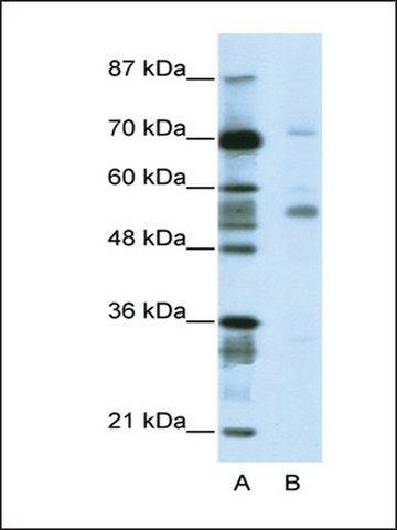 Anti-CORO1A (AB2) antibody produced in rabbit