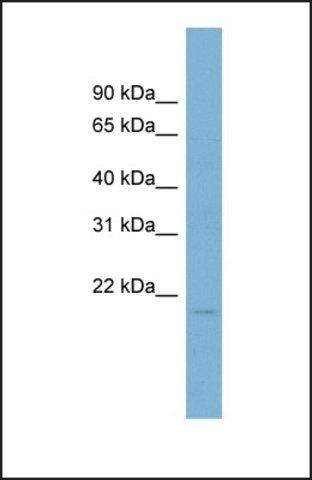 Anti-COTL1, (N-terminal) antibody produced in rabbit