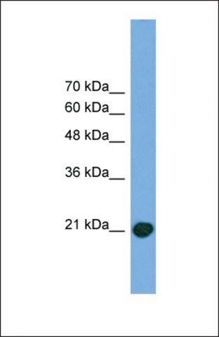 Anti-COMMD8 antibody produced in rabbit