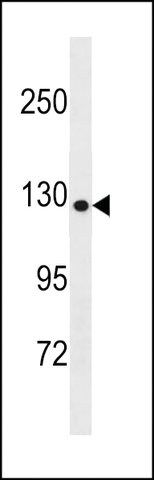 ANTI-COL19A1(N-TERMINAL) antibody produced in rabbit