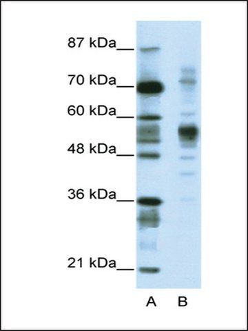 Anti-CORO1A (AB3) antibody produced in rabbit