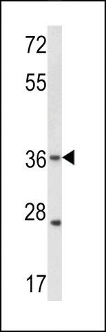 ANTI-CONNEXIN 31(C-TERMINAL) antibody produced in rabbit